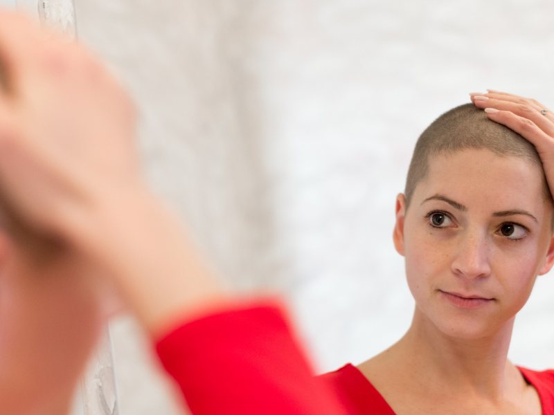 l'alopecia è tra le cause più temute della chemio